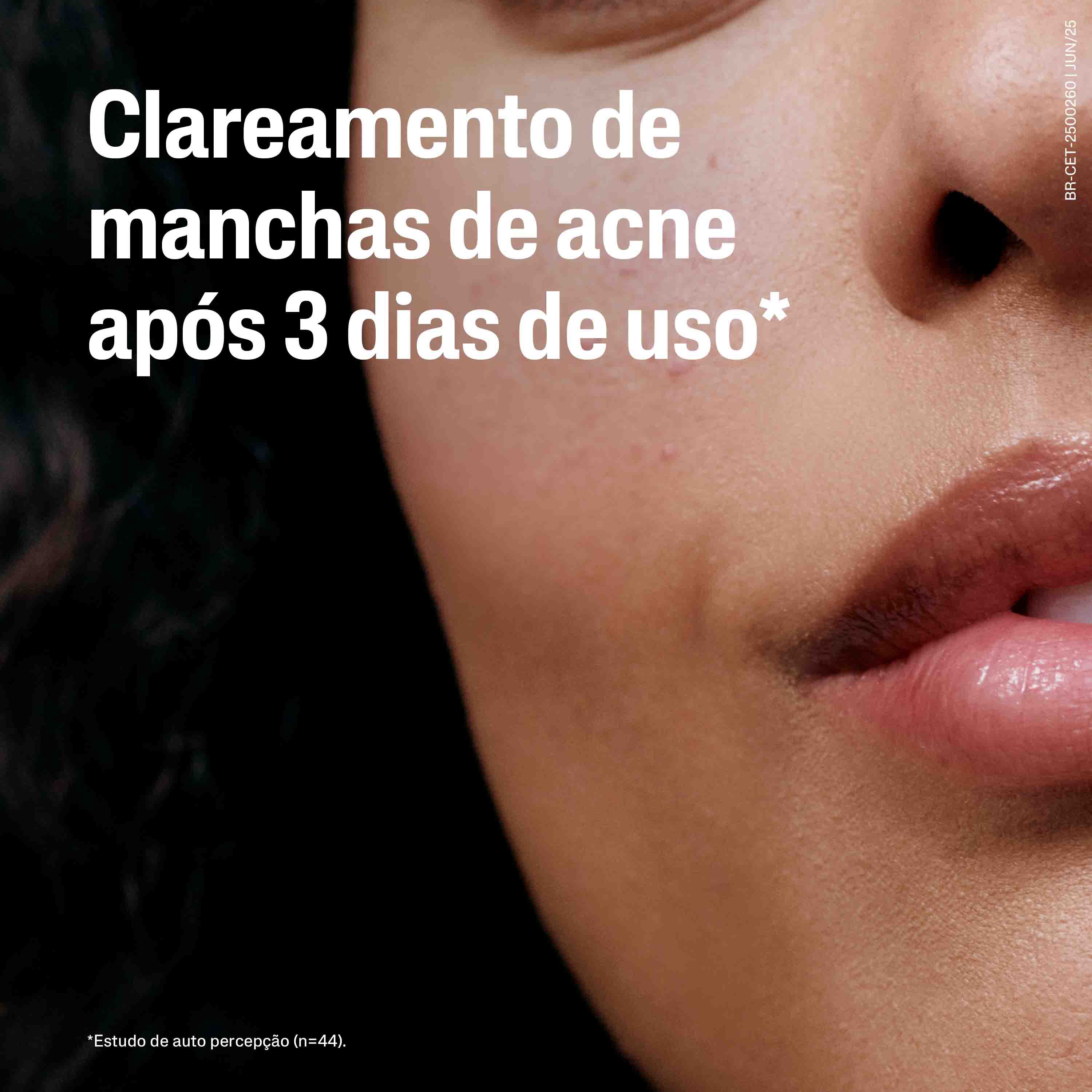 S&eacute;rum Tripla-a&ccedil;&atilde;o para Controle de Oleosidade Oil Control 30mL