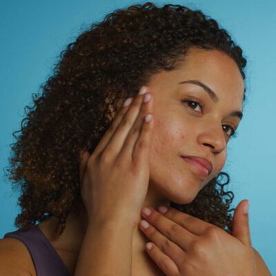 Uma mulher com pele com acne e cabelo encaracolado est&aacute; posando em frente a um fundo azul claro. Ela est&aacute; tocando seu rosto e pesco&ccedil;o com as m&atilde;os. A mulher est&aacute; olhando para a frente com um leve sorriso.