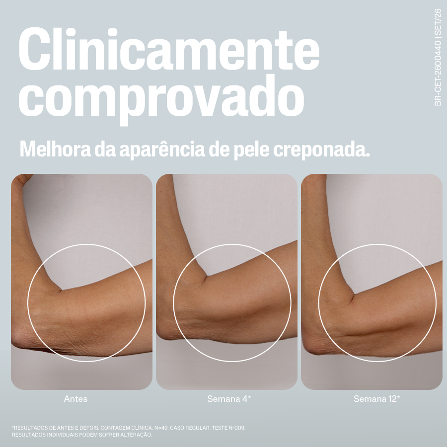  Lo&ccedil;&atilde;o Firmadora Skin Activator Cetaphil antes e depois