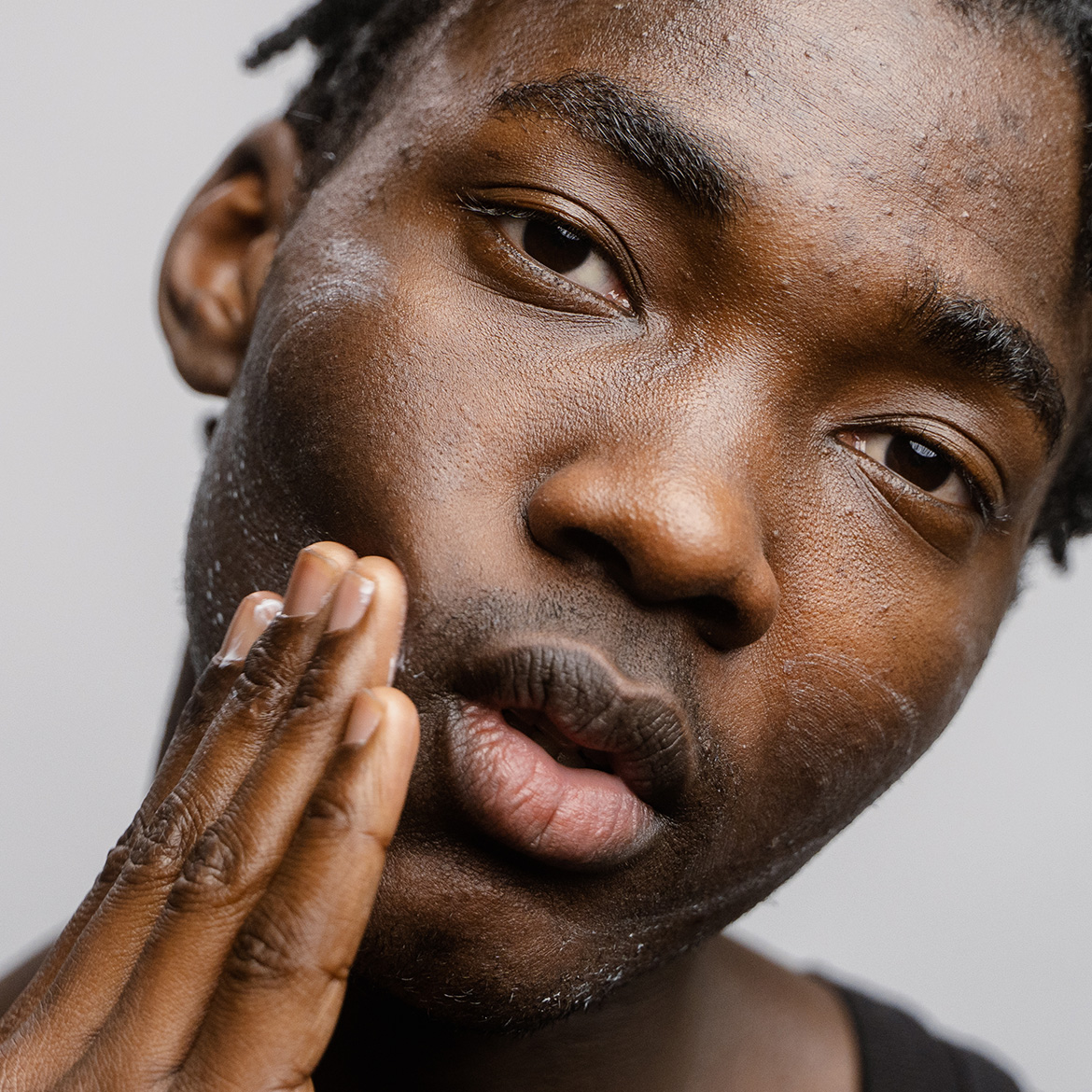 Necessidades da Pele